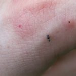 อาการแพ้จากแมลงสัตว์ กัดต่อยจะใช้สมุนไพรรักษาได้อย่างไร